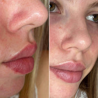 PORE PERFECTION KIT