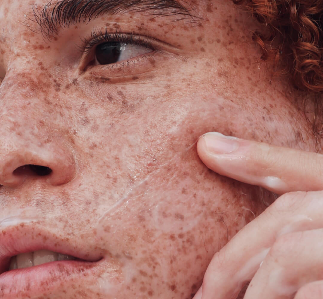 Skincare Ingredients: What Helps, What Hurts