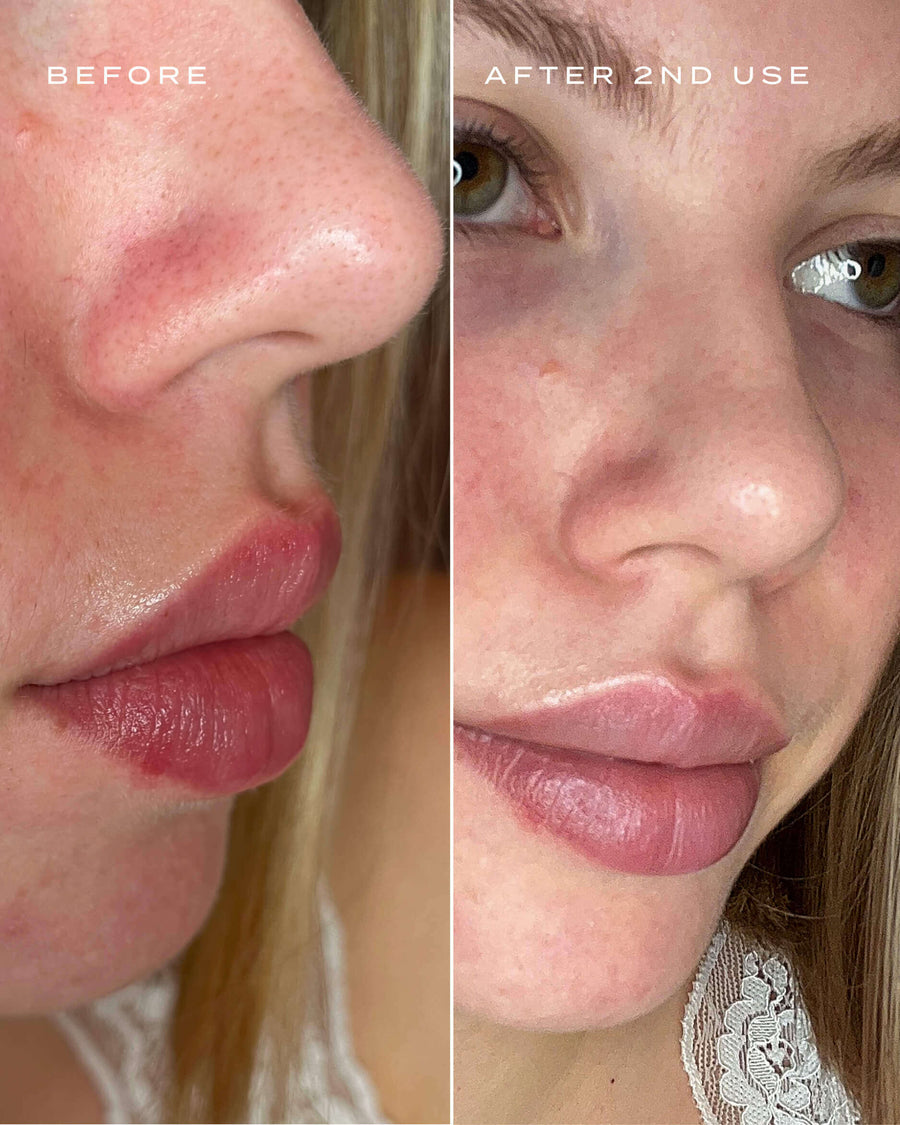 PORE PERFECTION KIT